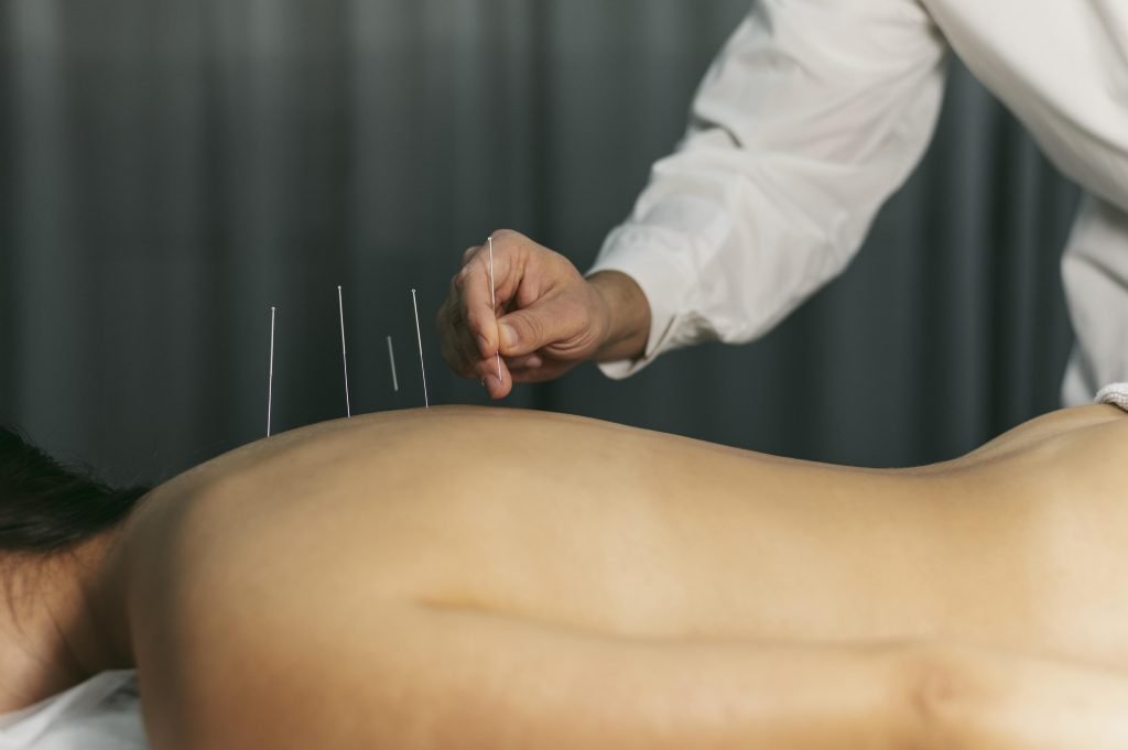 Acupuncturist in Zwolle